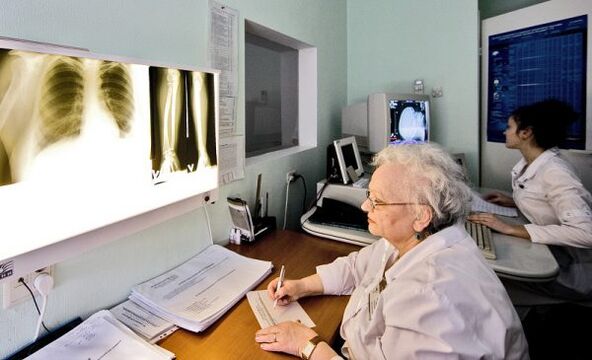 Radiographie utilisée pour diagnostiquer les maux de dos