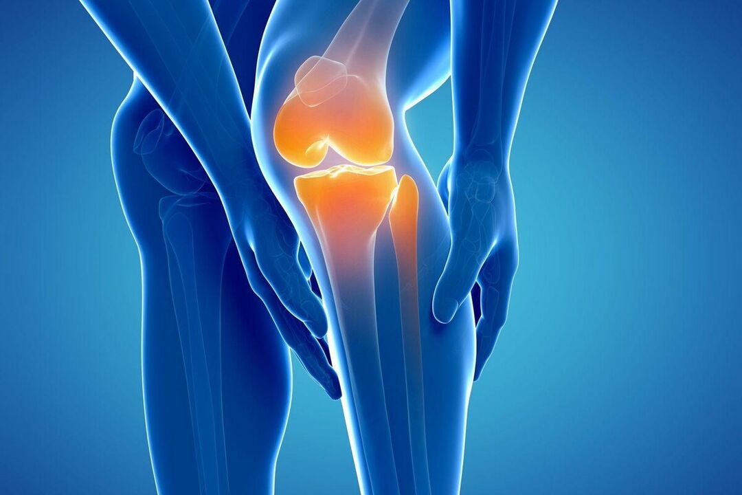 Qu'est-ce que l'arthrose